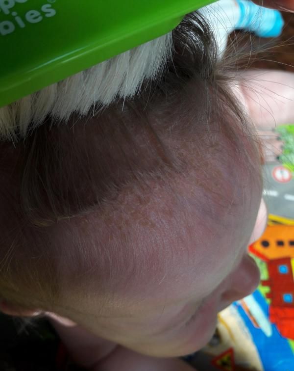 Шампунь детский Babe Pediatric для сухой кожи головы от себорейных корочек фото